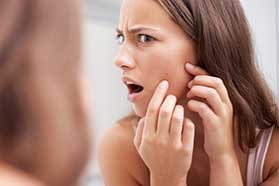 Acne Treatment in Raleigh, NC