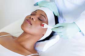 Micro needling treatment in Indianapolis, IN