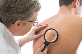 Actinic Keratosis in Lincoln Park, NJ